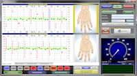 biocheck Pro Software: Overview